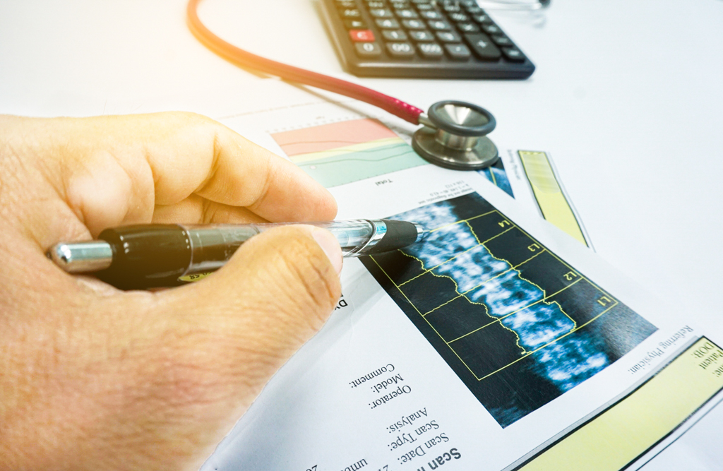 How Can a DEXA Scan Help Identify Osteoporosis?
