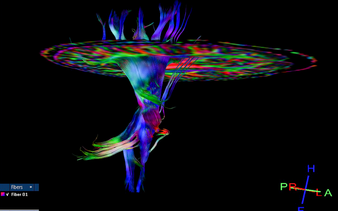 DTI Plays Major Role in $6 Million South Florida Settlement