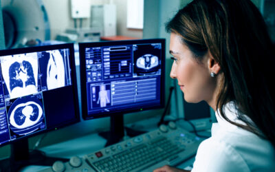 The History of the Digital X-Ray