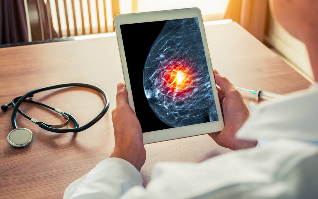New Year, New Scan: The Importance of a Mammogram